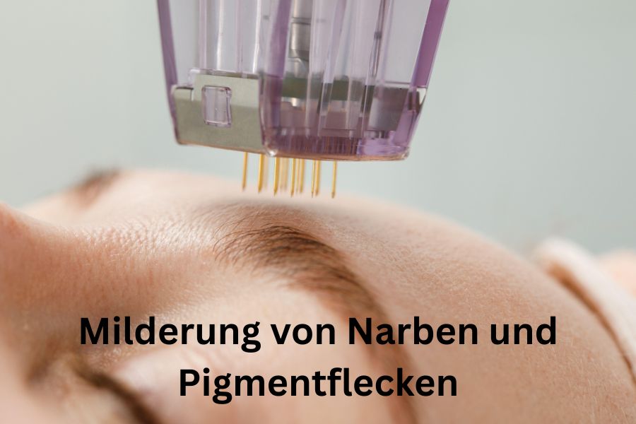 Microneedling im Gesicht Agenbrauen
