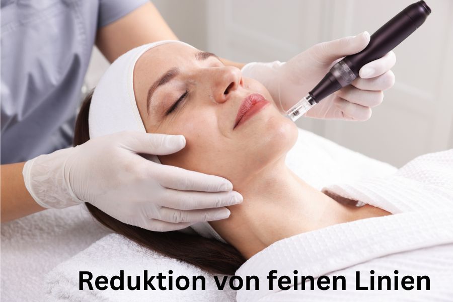 Reduktion von feinen Linien